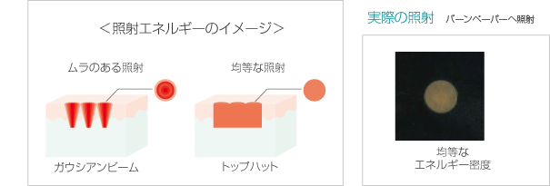従来のレーザーとの違い